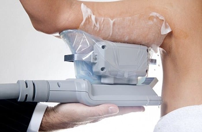 fat freezing arms West Norwood