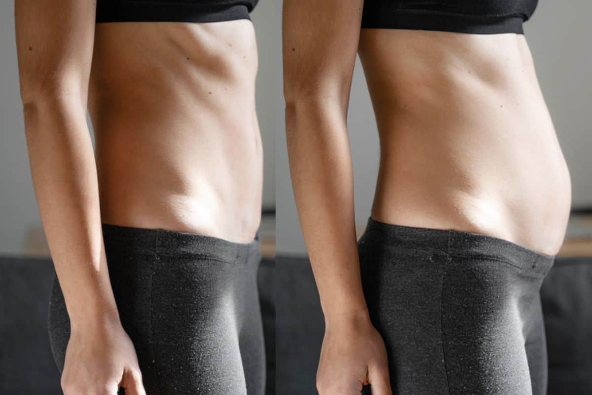 How long does diastasis recti take to improve West Norwood?