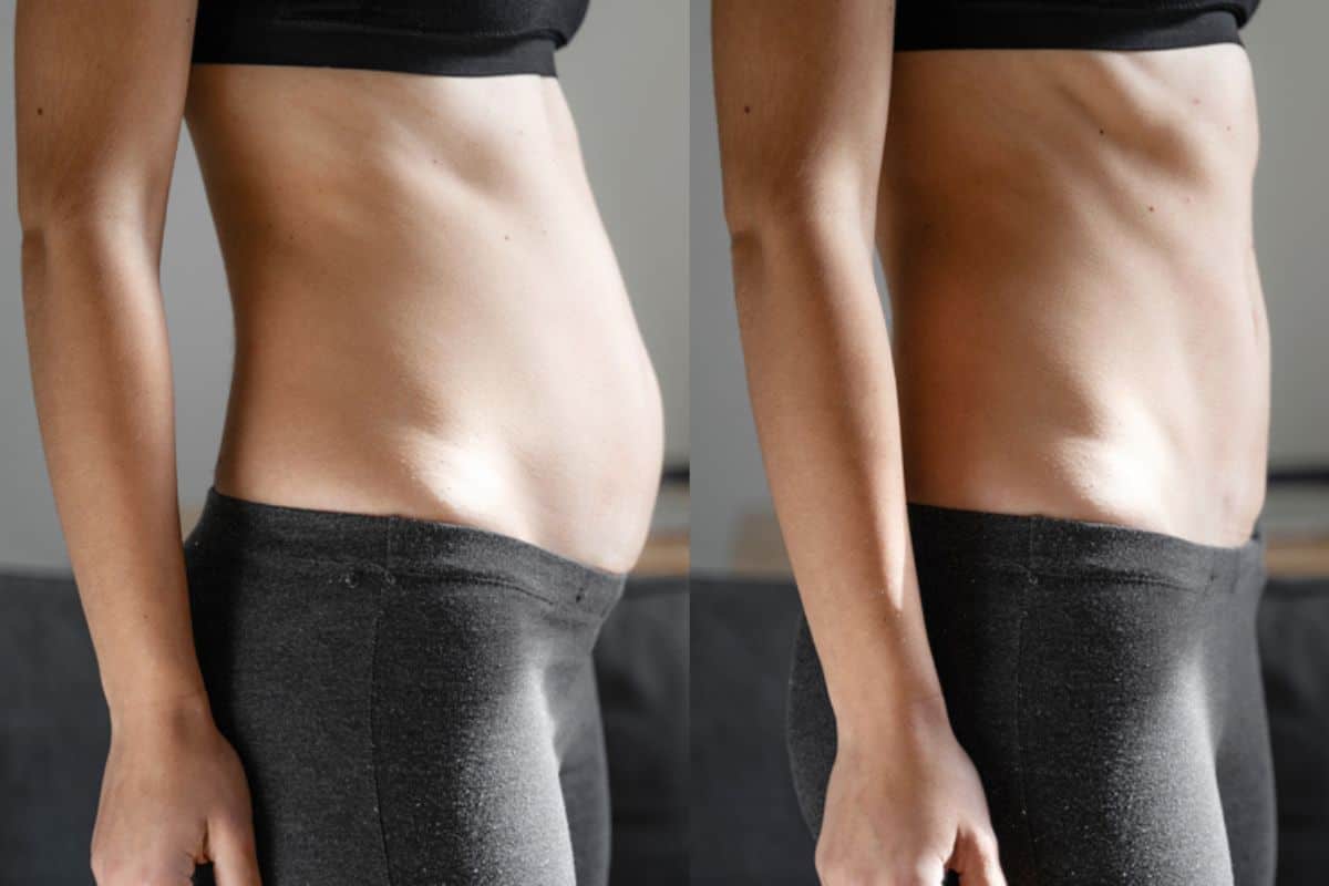 Post-Pregnancy: What Happens to Your Abdominal Muscles After Birth West Norwood