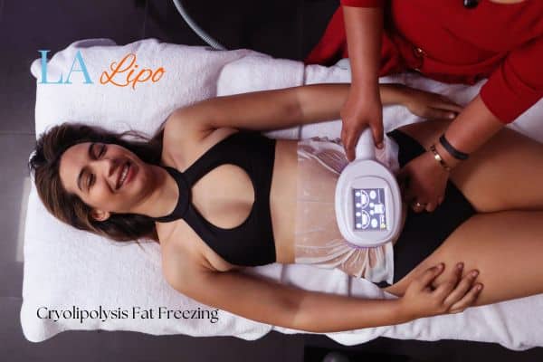 woman getting cryolipolysis West Norwood