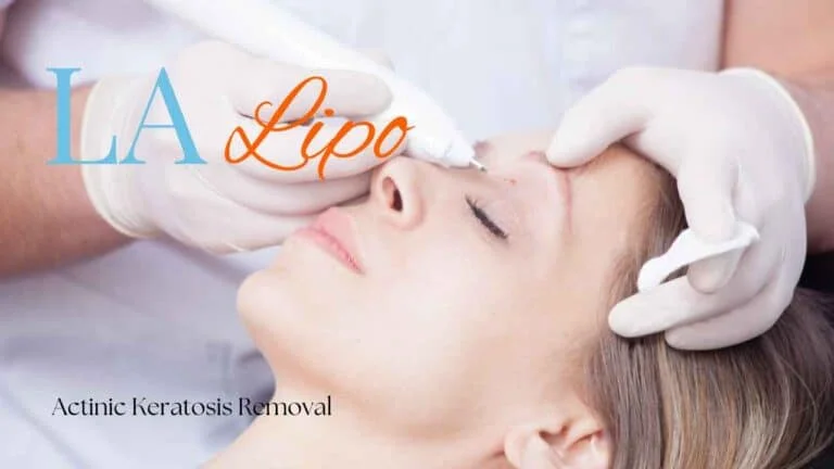 Woman receiving Actinic Keratosis Removal Treatment West Norwood