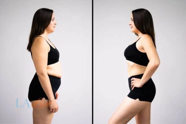 LA-EMS Body Sculpting West Norwood results before and after of womans results on body toning.