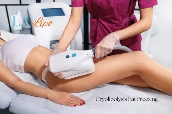 Woman receiving coolsculpting West Norwood treatment on her thighs