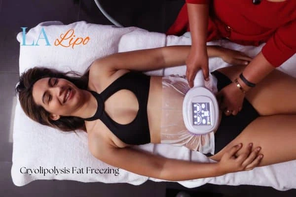 woman getting cryolipolysis West Norwood