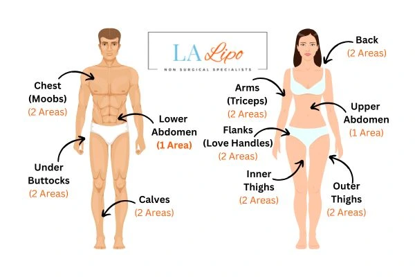 LA LIPO Cryolipolysis Areas West Norwood