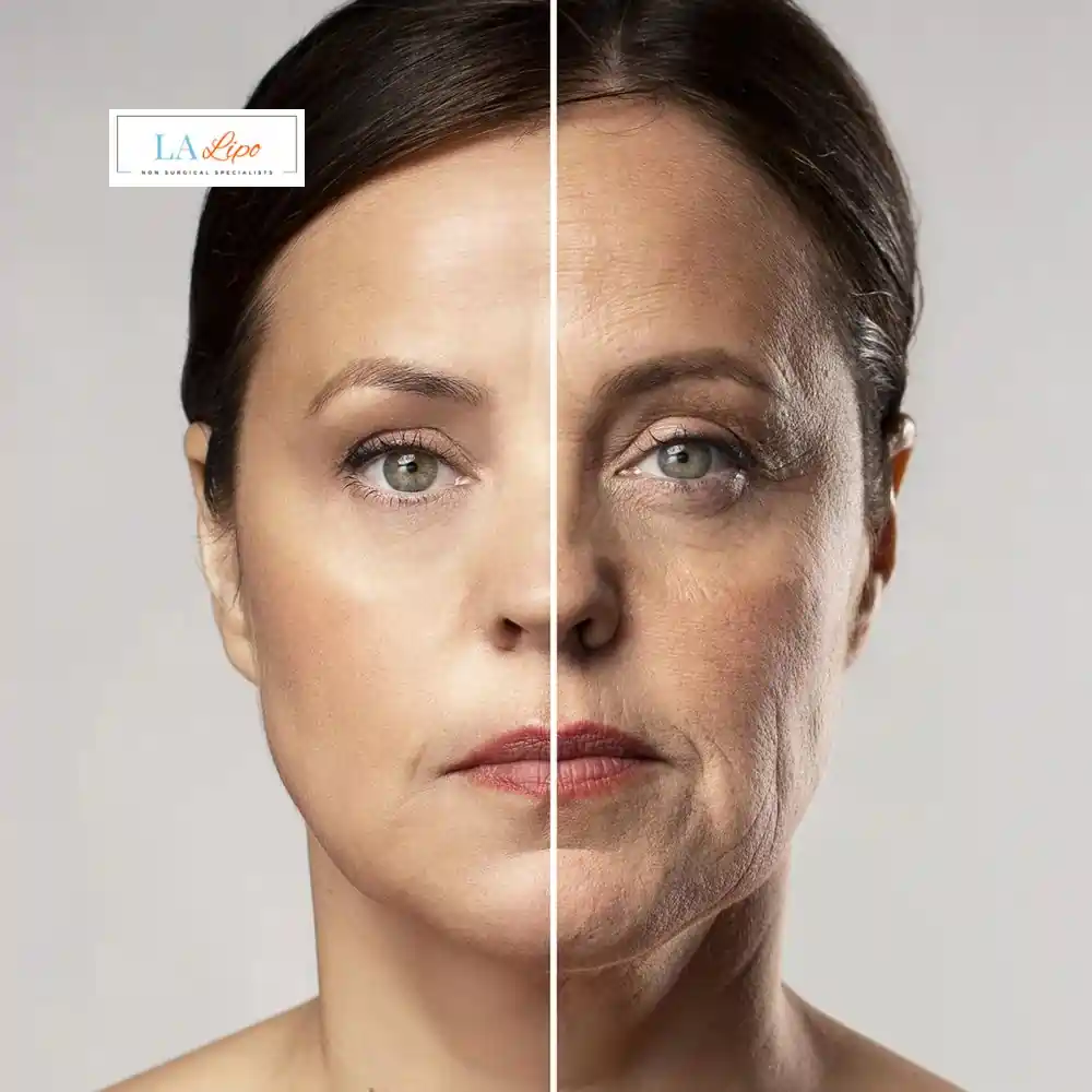 How Can You Tell If Non-Surgical Skin Tightening Is Right for You West Norwood?