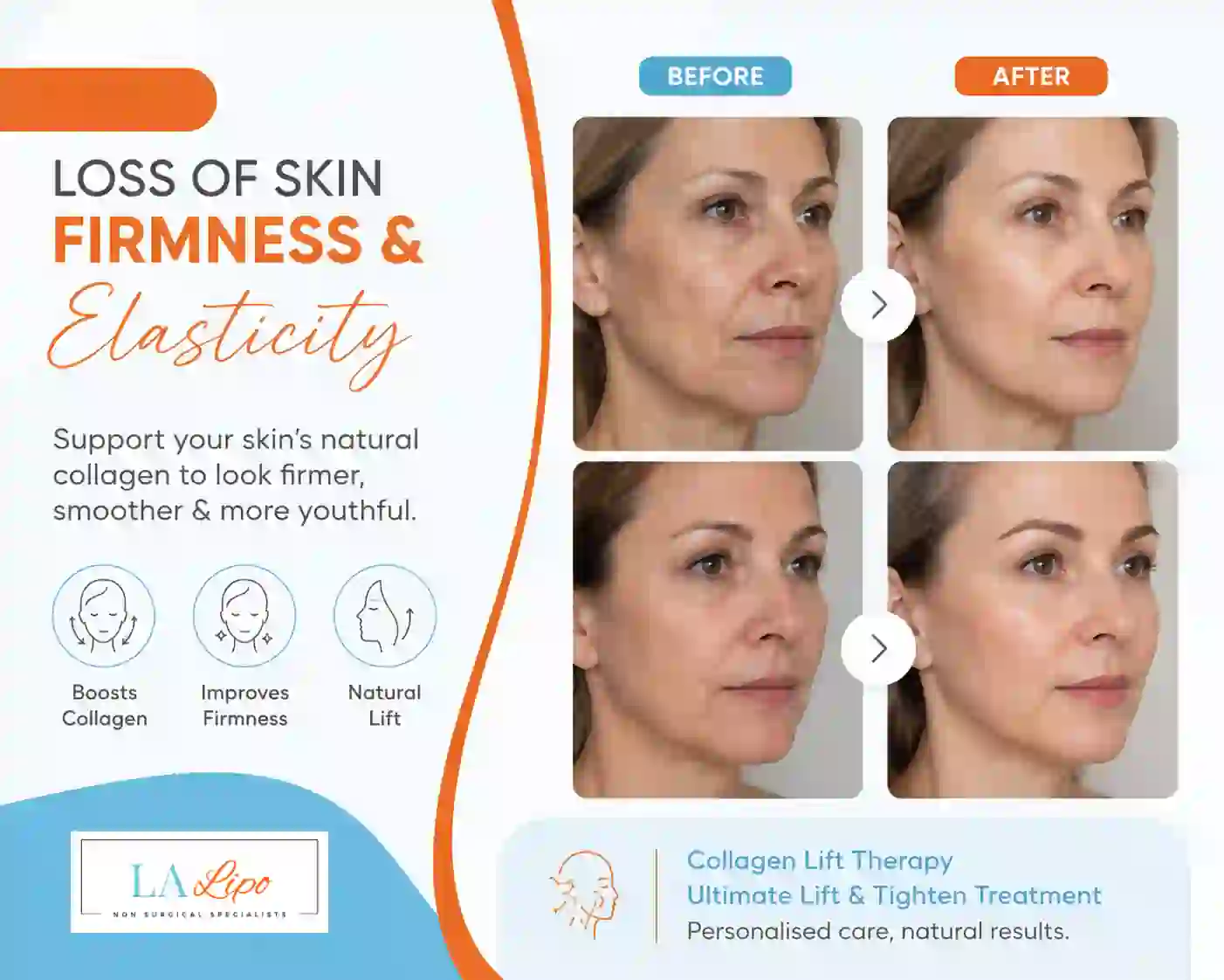 Sign #7: Loss of Skin Firmness and Elasticity West Norwood