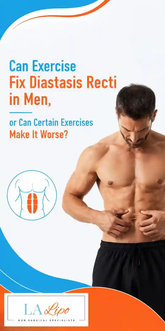 Can Exercise Fix Diastasis Recti in Men, or Can Certain Exercises Make It Worse West Norwood?