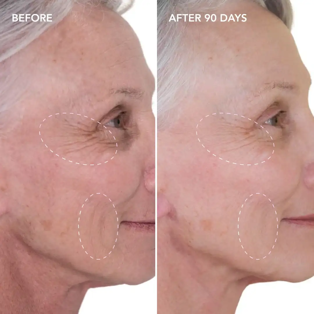 When will you see results West Norwood